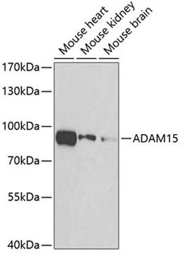 Western blot - ADAM15 antibody (A7756)