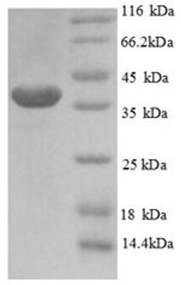 (Tris-Glycine gel) Discontinuous SDS-PAGE (reduced) with 5% enrichment gel and 15% separation gel.
