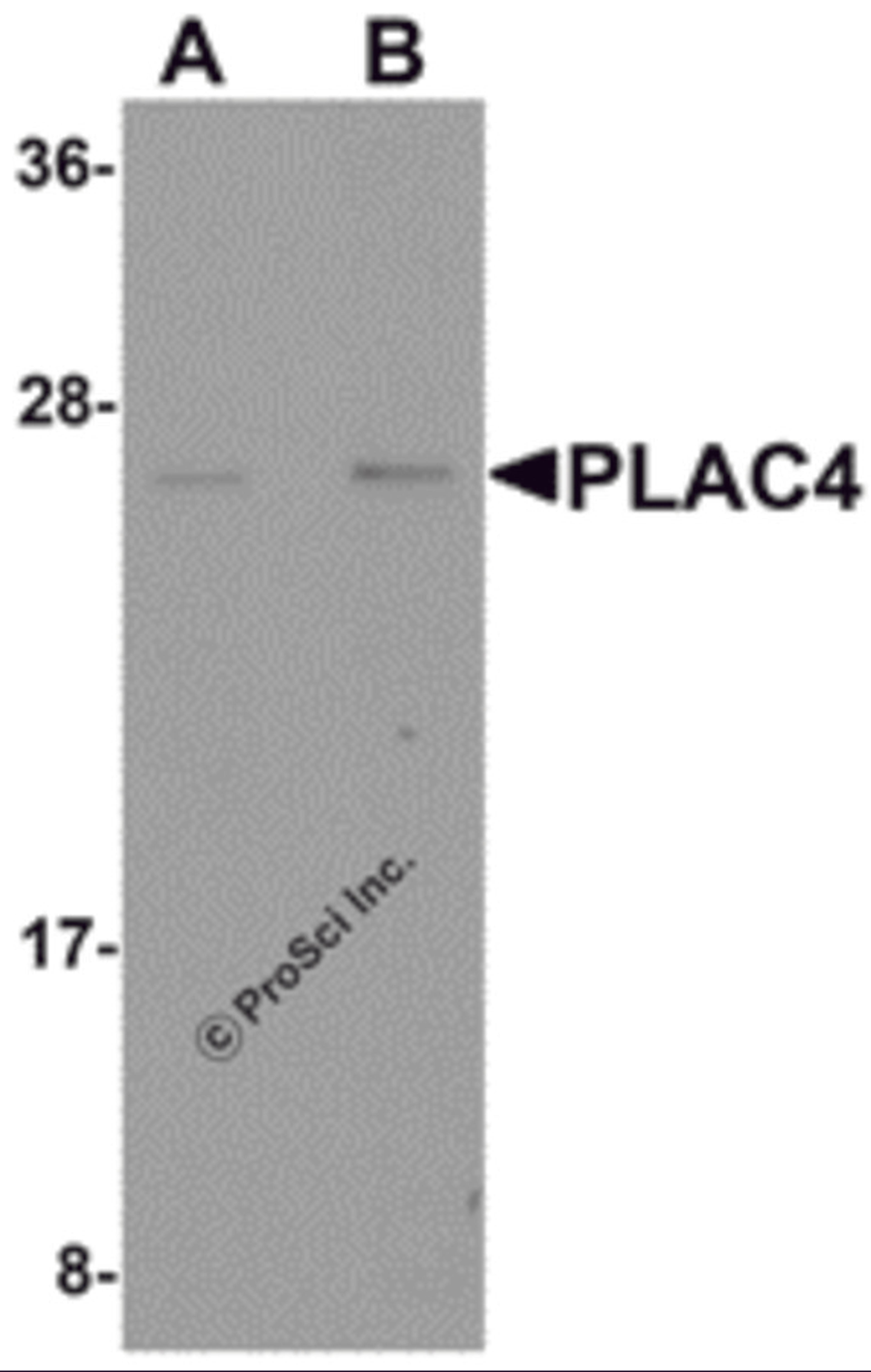 Western blot analysis of PLAC4 in human placenta tissue lysate with PLAC4 antibody at (A) 1 and (B) 2 &#956;g/mL.