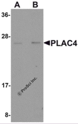 Western blot analysis of PLAC4 in human placenta tissue lysate with PLAC4 antibody at (A) 1 and (B) 2 μg/mL.