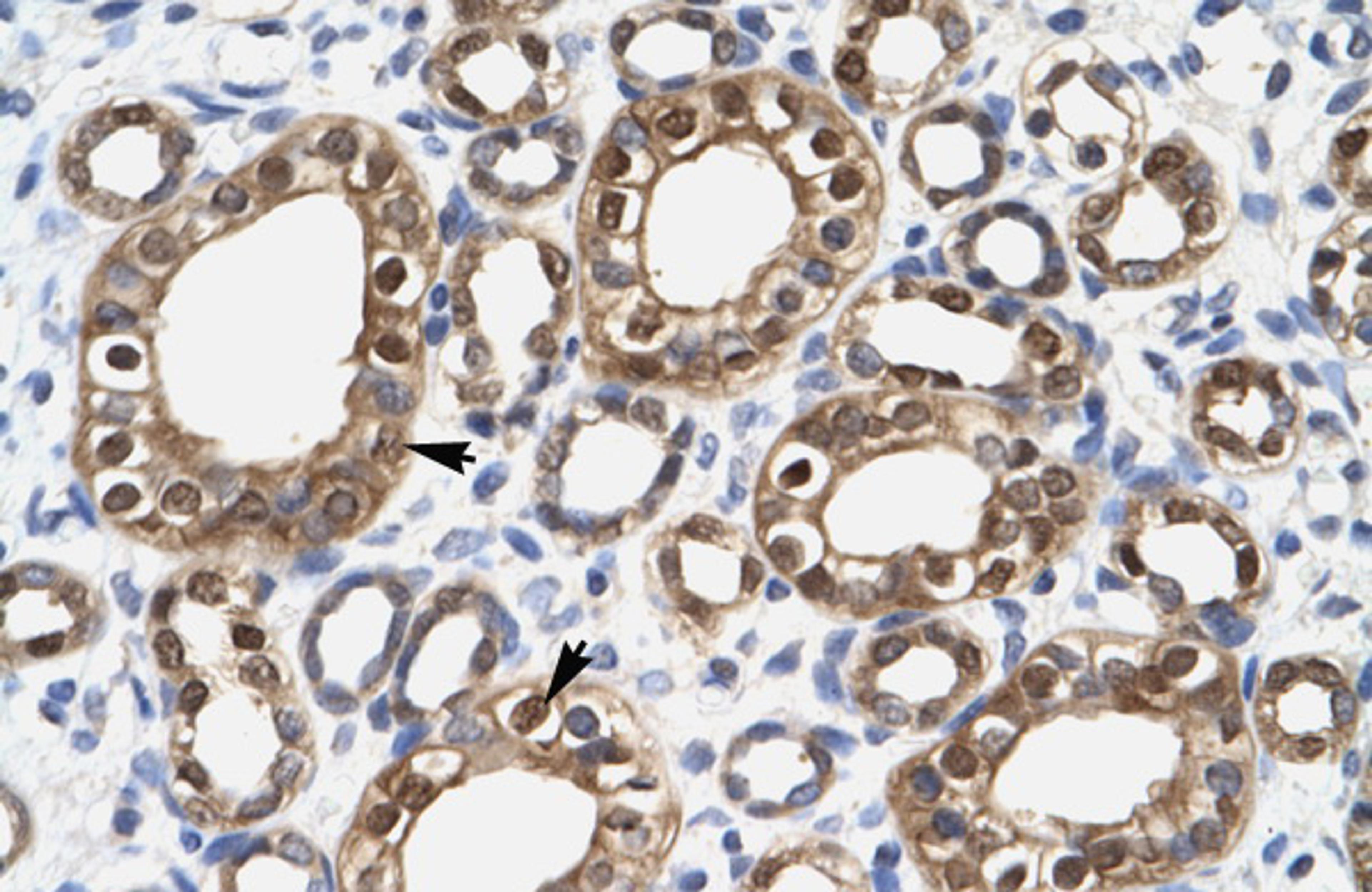 Antibody used in IHC on Human kidney.