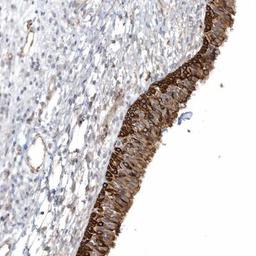 Immunohistochemistry-Paraffin: DNAH1 Antibody [NBP1-90490] - Staining of human nasopharynx shows strong cytoplasmic and membranous positivity in respiratory epithelial cells.