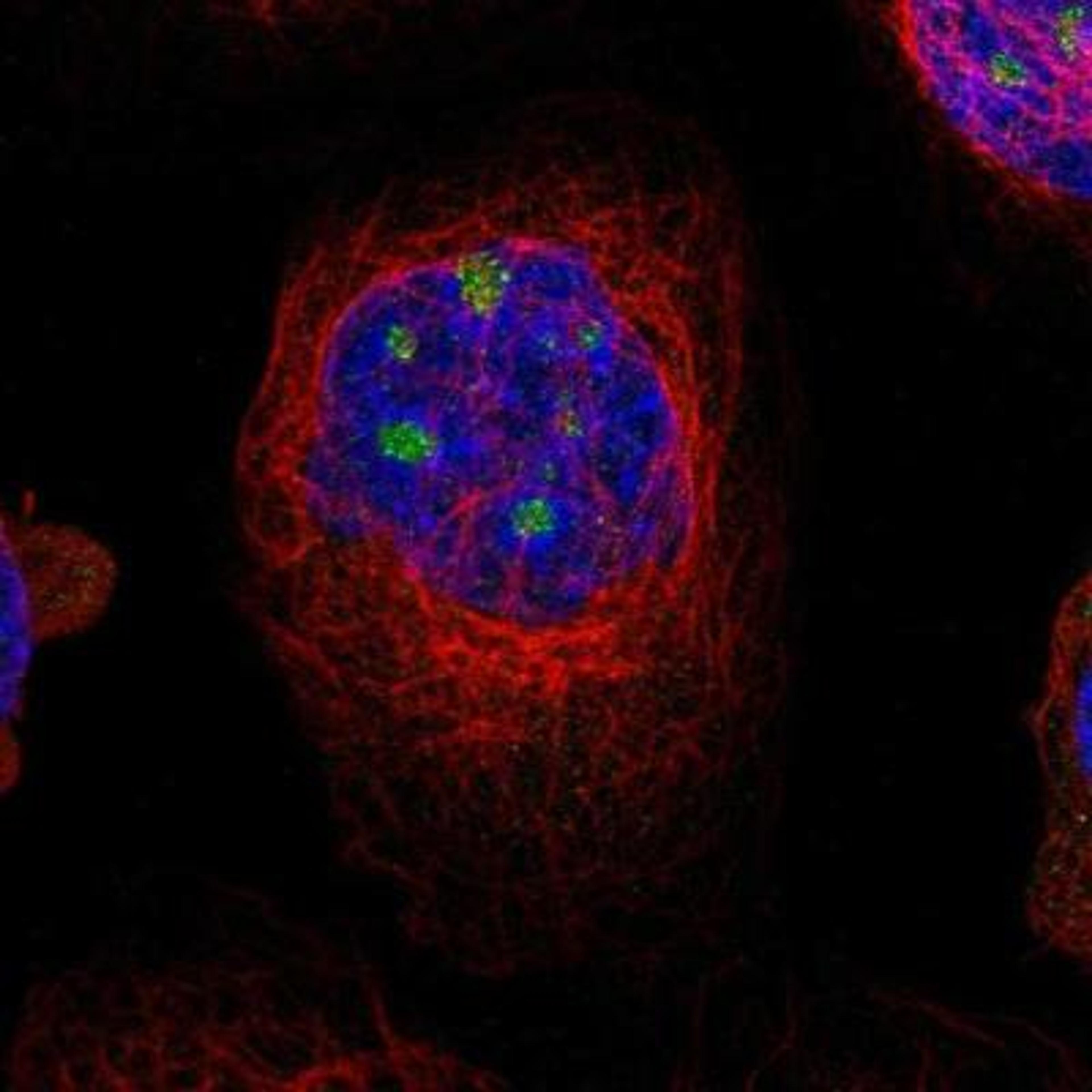 Immunocytochemistry/Immunofluorescence: 5-HT2A Antibody [NBP1-90318] - Staining of human cell line A-431 shows positivity in nucleoli.