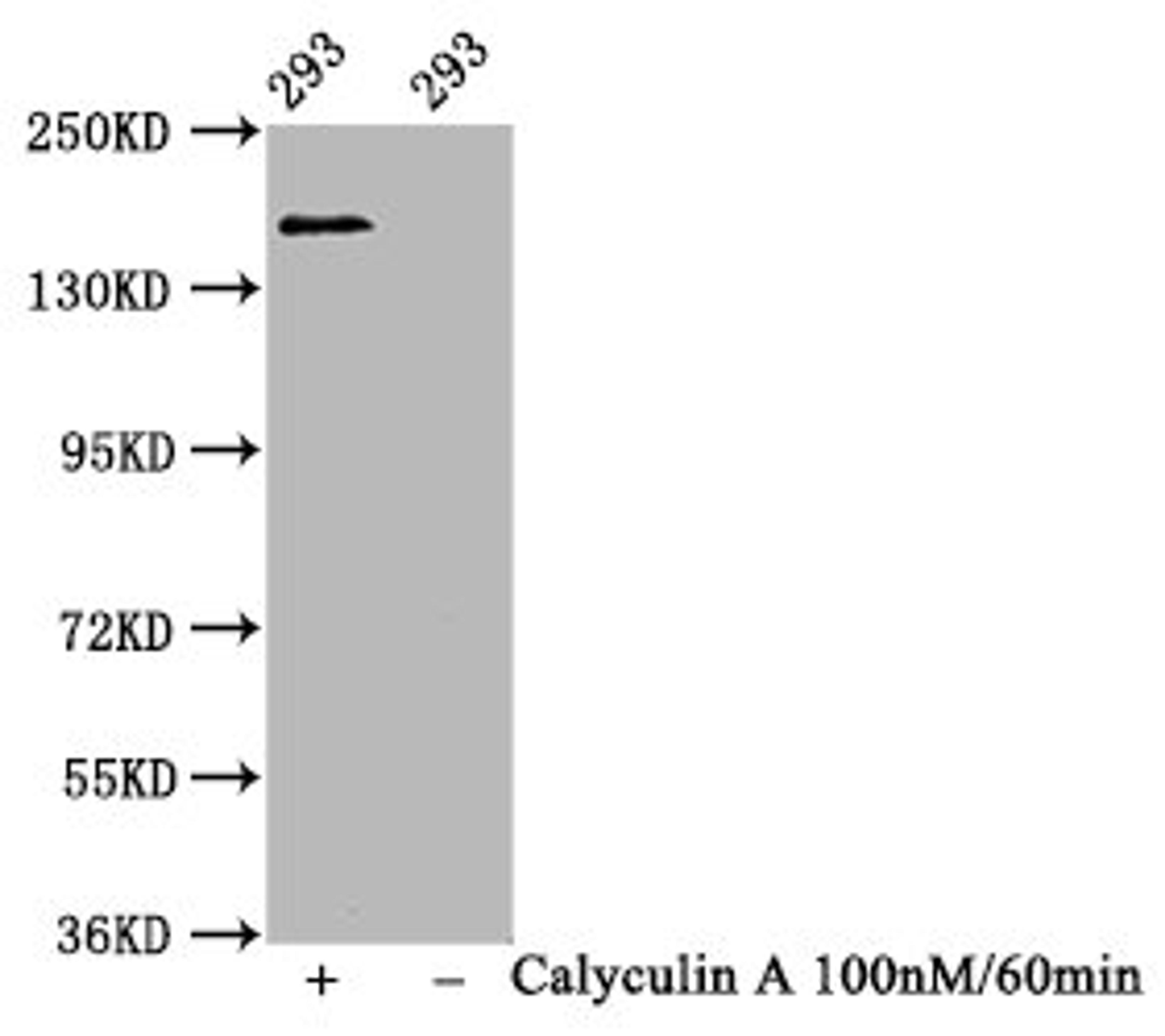Western Blot. Positive WB detected in 293 whole cell lysate(treated with Calyculin A or not). All lanes Phospho-SMC1A antibody at 1.11μg/ml. Secondary. Goat polyclonal to rabbit IgG at 1/50000 dilution. Predicted band size: 160 KDa. Observed band size: 160 KDa. 
