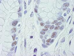 Detection of human CDK11 by immunohistochemistry.