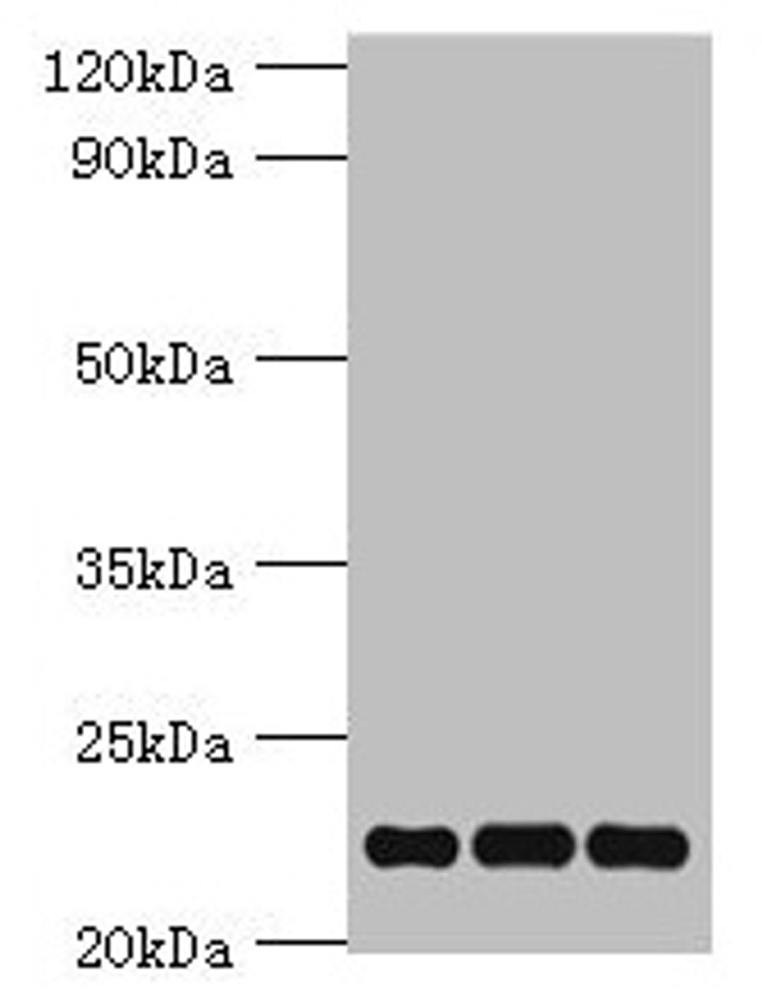 Western blot. All lanes: PRDX5 antibody at 4µg/ml. Lane 1: Mouse brain tissue. Lane 2: Hela whole cell lysate. Lane 3: 293T whole cell lysate. Secondary. Goat polyclonal to rabbit IgG at 1/10000 dilution. Predicted band size: 23, 18, 13 kDa. Observed band size: 23 kDa