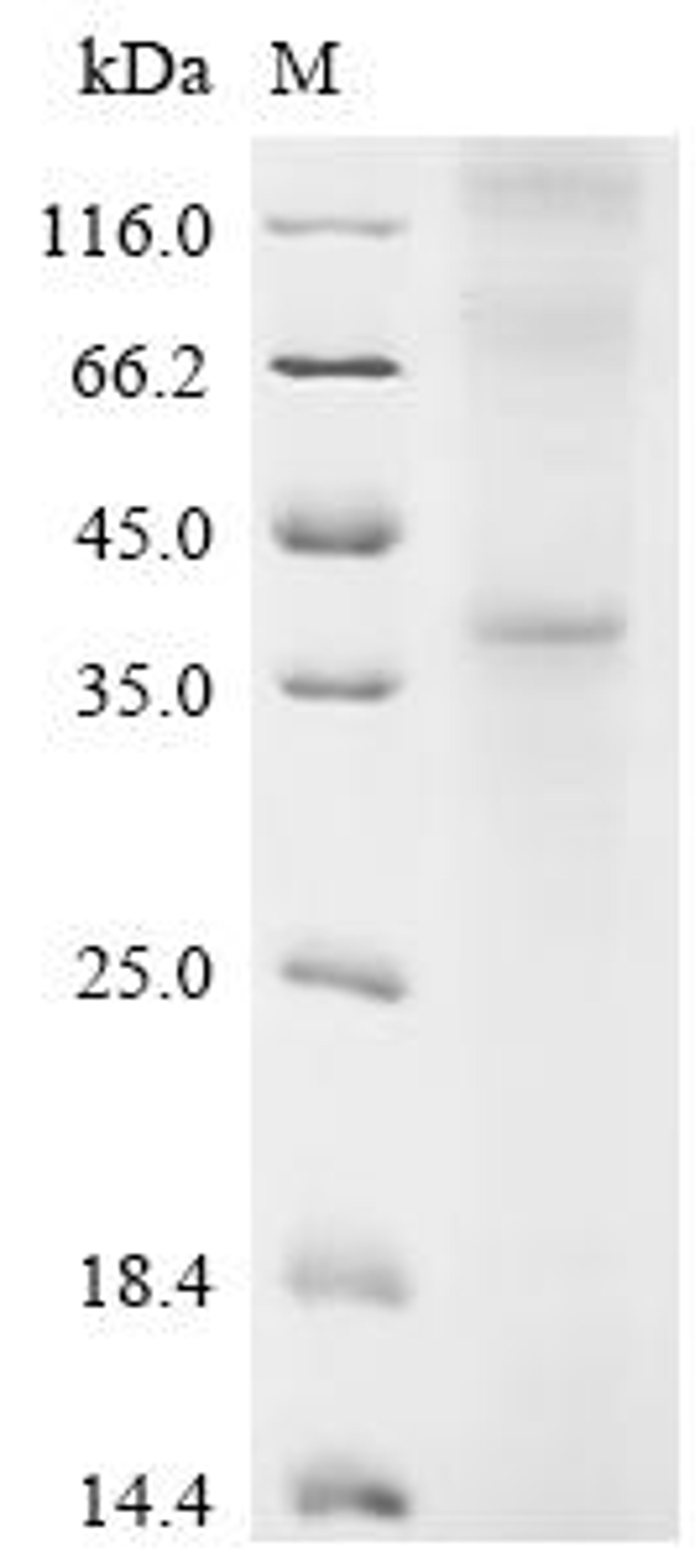 (Tris-Glycine gel) Discontinuous SDS-PAGE (reduced) with 5% enrichment gel and 15% separation gel.