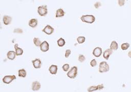 Detection of human PDGFR alpha by immunocytochemistry.