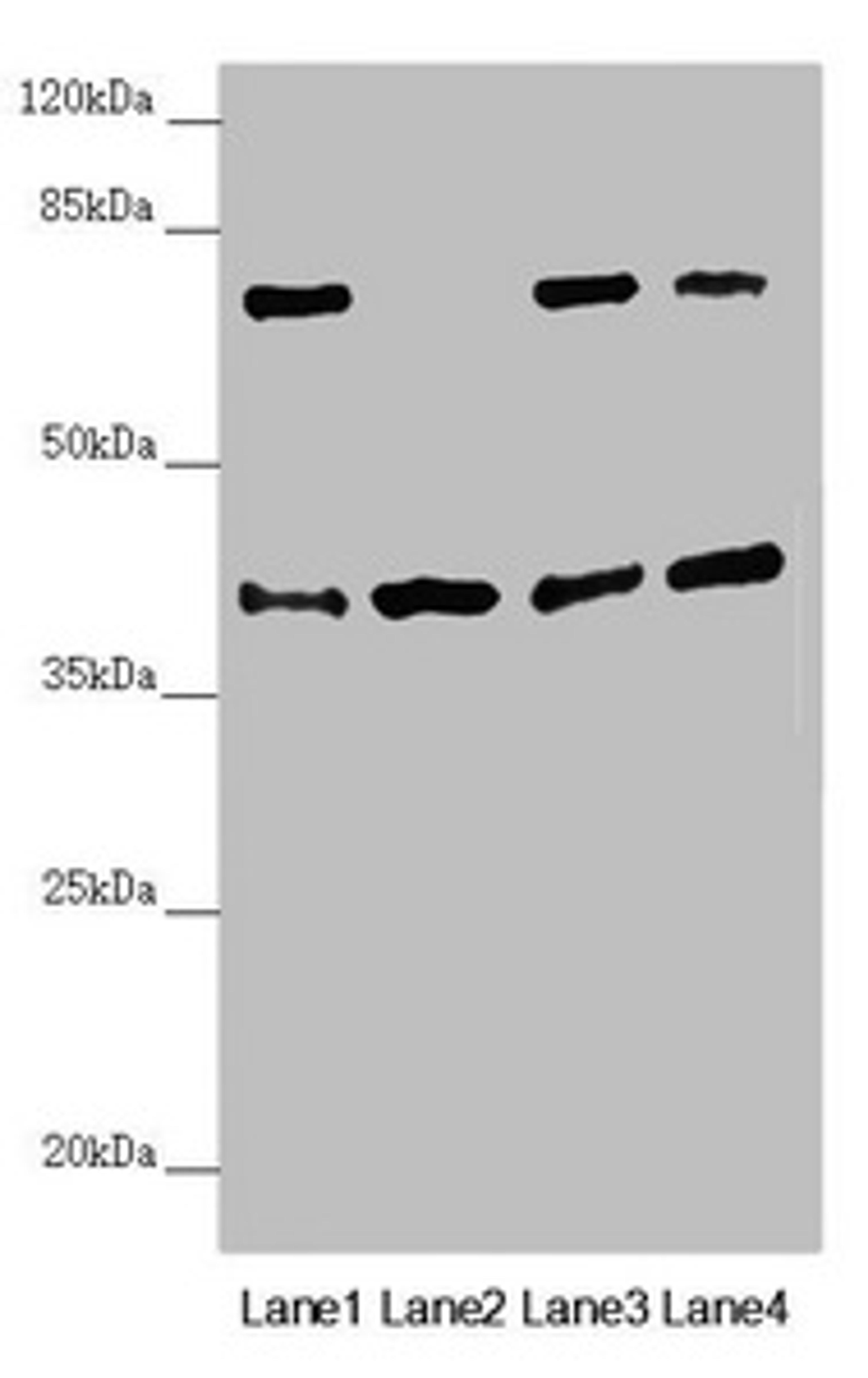 Western blot. All lanes: DSN1 antibody at 2.19 ug/ml. Lane 1: Hela whole cell lysate. Lane 2: Mouse skeletal muscle tissue. Lane 3: Mouse lung tissue. Lane 4: Mouse stomach tissue. Secondary. Goat polyclonal to rabbit IgG at 1/10000 dilution. Predicted band size: 41, 33, 39, 28 kDa. Observed band size: 41, 70 kDa. 