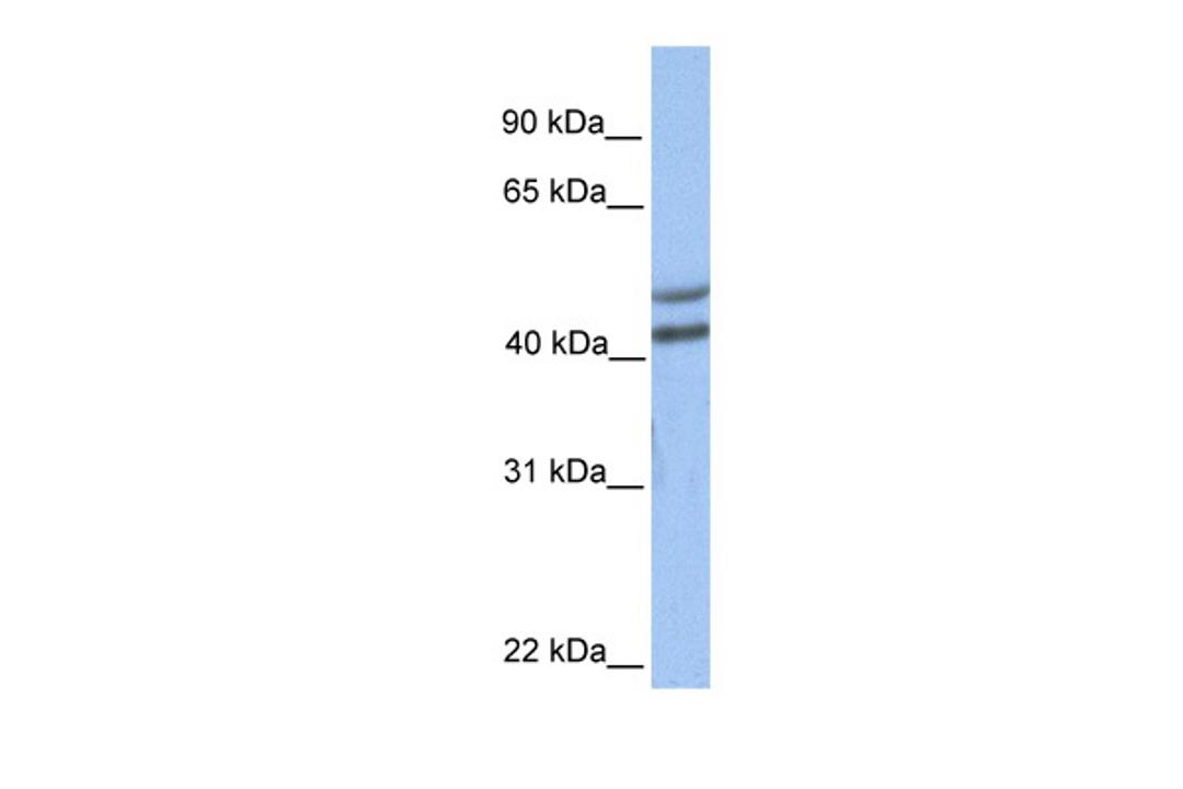 Antibody used in WB on Human Brain at 0.2-1 ug/ml.