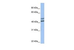 Antibody used in WB on Human Brain at 0.2-1 ug/ml.