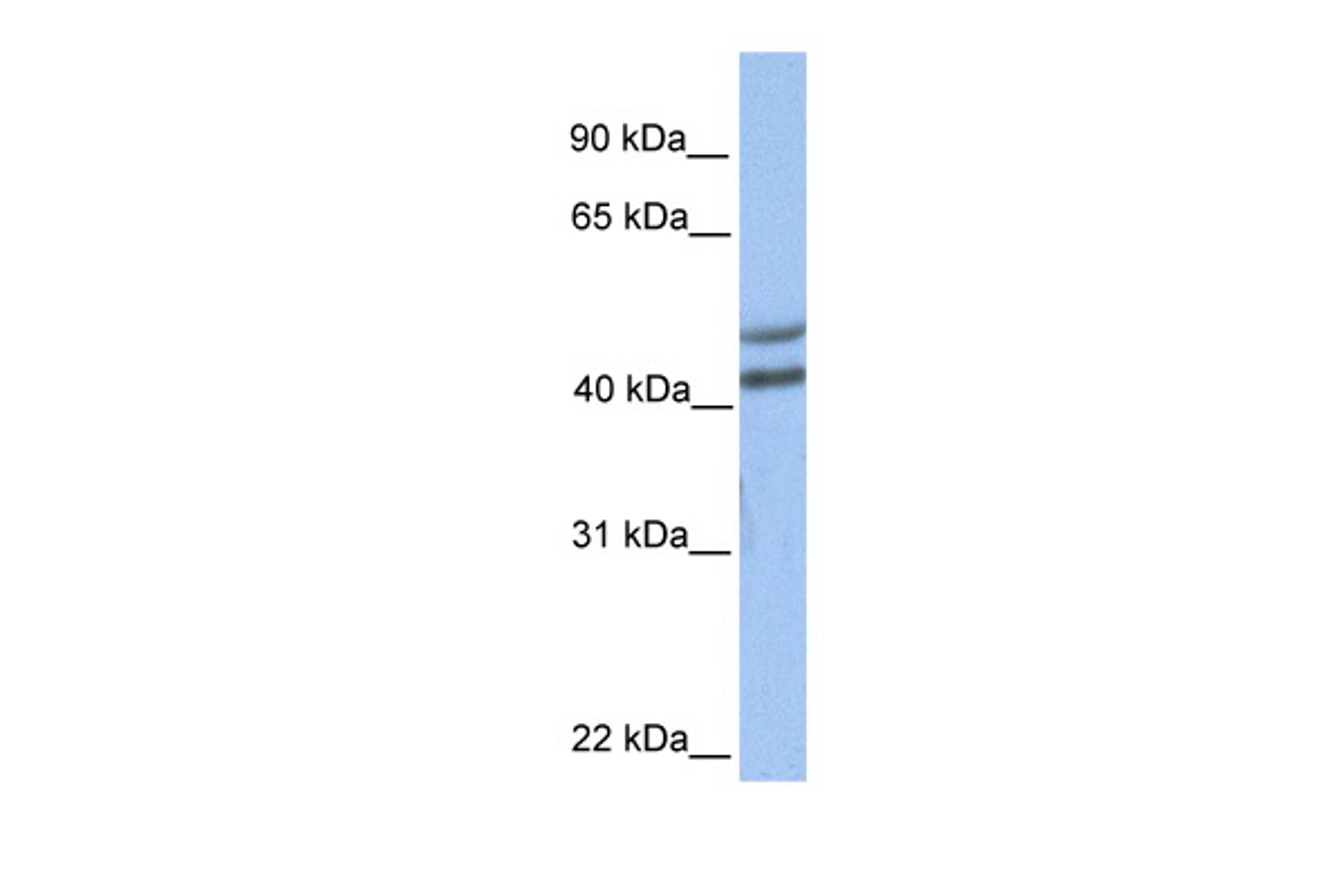 Antibody used in WB on Human Brain at 0.2-1 ug/ml.