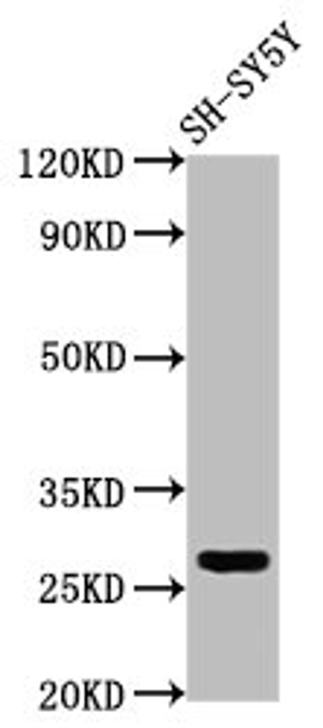 Western Blot. Positive WB detected in: SH-SY5Y whole cell lysate. All lanes: CD99L2 antibody at 4µg/ml. Secondary. Goat polyclonal to rabbit IgG at 1/50000 dilution. Predicted band size: 28, 23, 21, 16, 29 kDa. Observed band size: 28 kDa