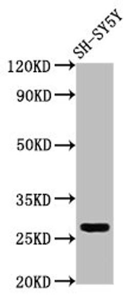 Western Blot. Positive WB detected in: SH-SY5Y whole cell lysate. All lanes: CD99L2 antibody at 4µg/ml. Secondary. Goat polyclonal to rabbit IgG at 1/50000 dilution. Predicted band size: 28, 23, 21, 16, 29 kDa. Observed band size: 28 kDa
