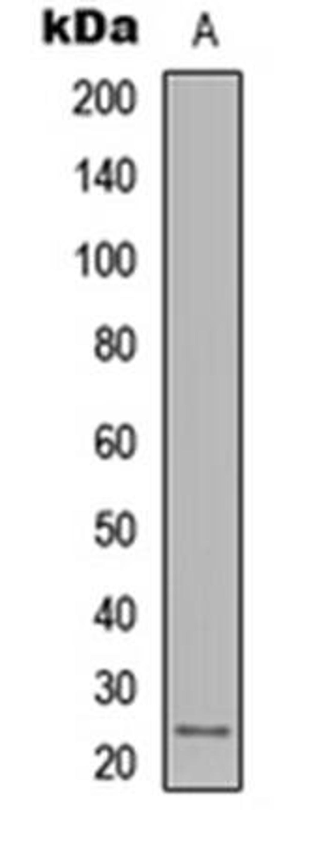 Western blot analysis of MDA-MB231 (Lane1) whole cell using IL-12A antibody