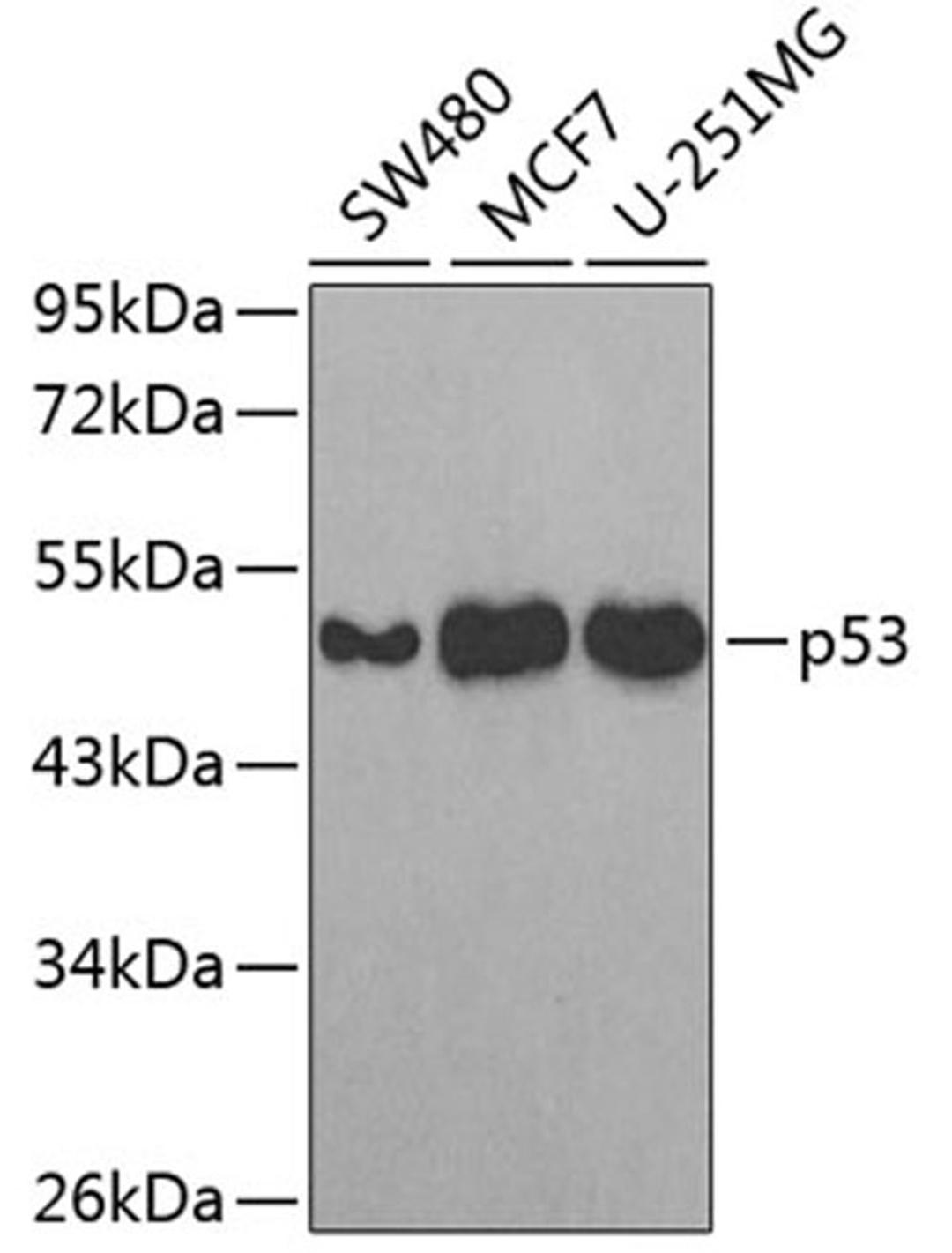 Western blot - p53 antibody (A3185)