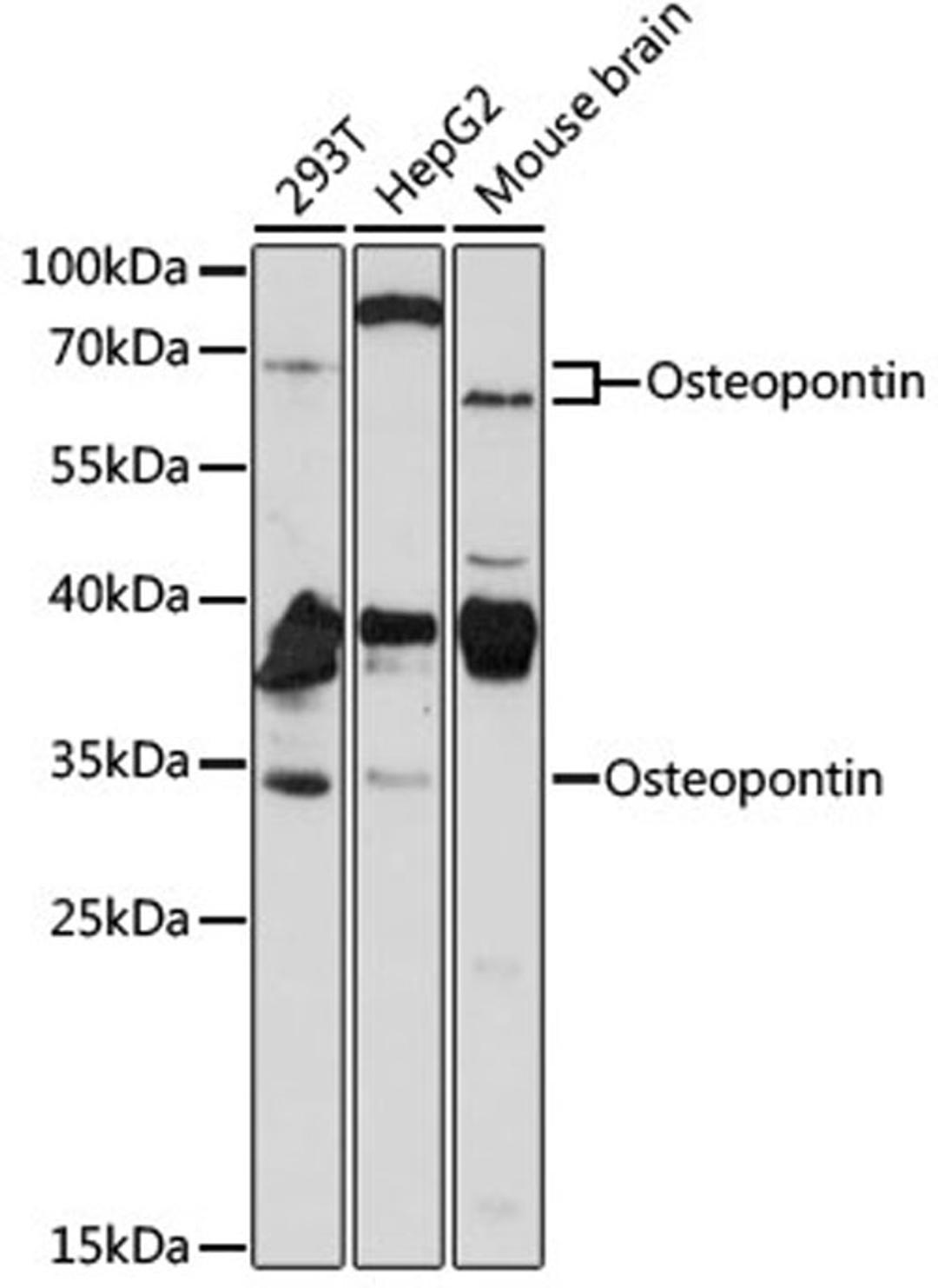 Western blot - Osteopontin antibody (A1361)