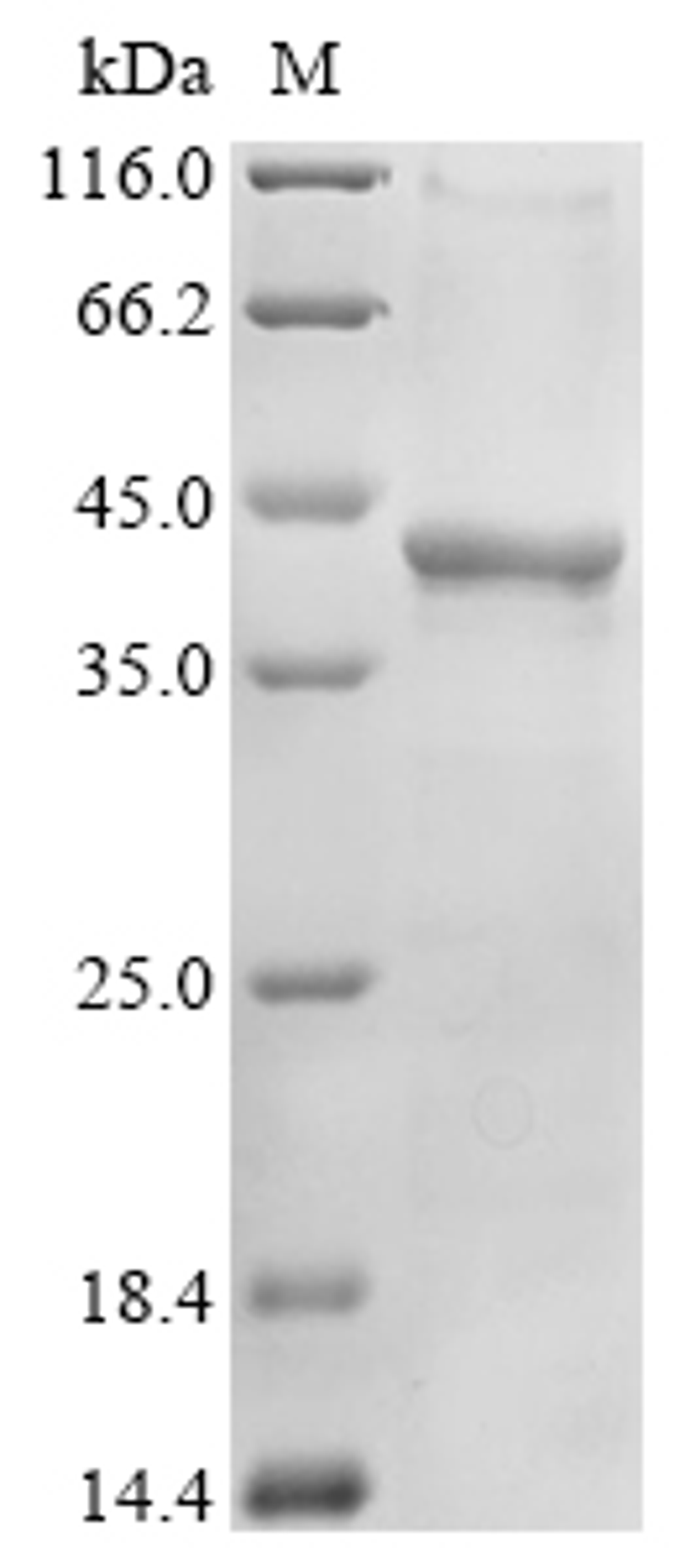 (Tris-Glycine gel) Discontinuous SDS-PAGE (reduced) with 5% enrichment gel and 15% separation gel.