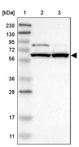 Western Blot: TBRG4 Antibody [NBP1-85478] - Lane 1: Marker [kDa] 230, 130, 95, 72, 56, 36, 28, 17, 11<br/>Lane 2: Human cell line RT-4<br/>Lane 3: Human cell line U-251MG sp