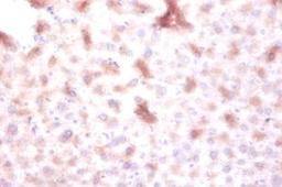 Immunohistochemistry of paraffin-embedded mouse liver tissue using CSB-PA007219EA01HU at dilution of 1:100