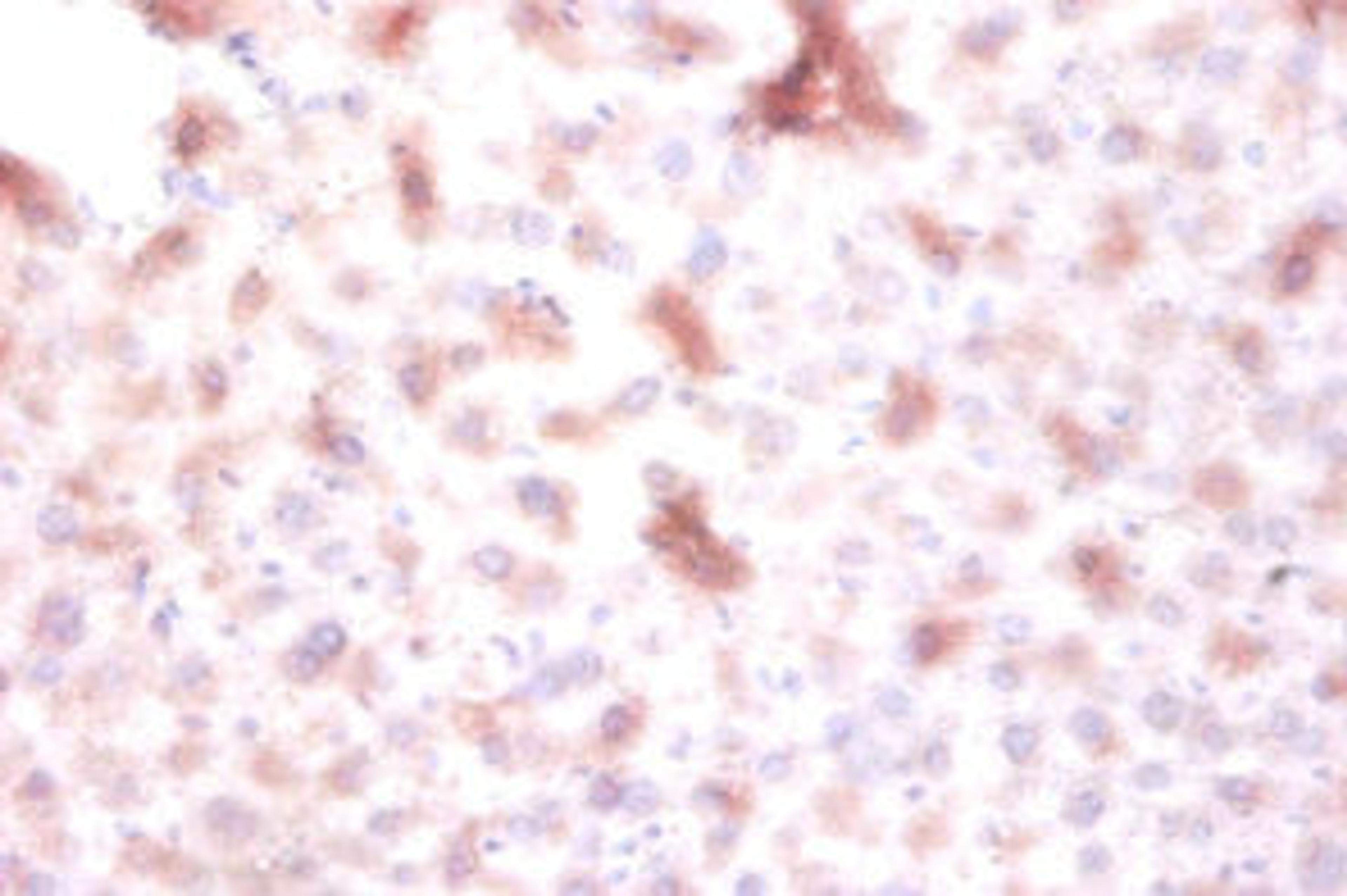Immunohistochemistry of paraffin-embedded mouse liver tissue using CSB-PA007219EA01HU at dilution of 1:100