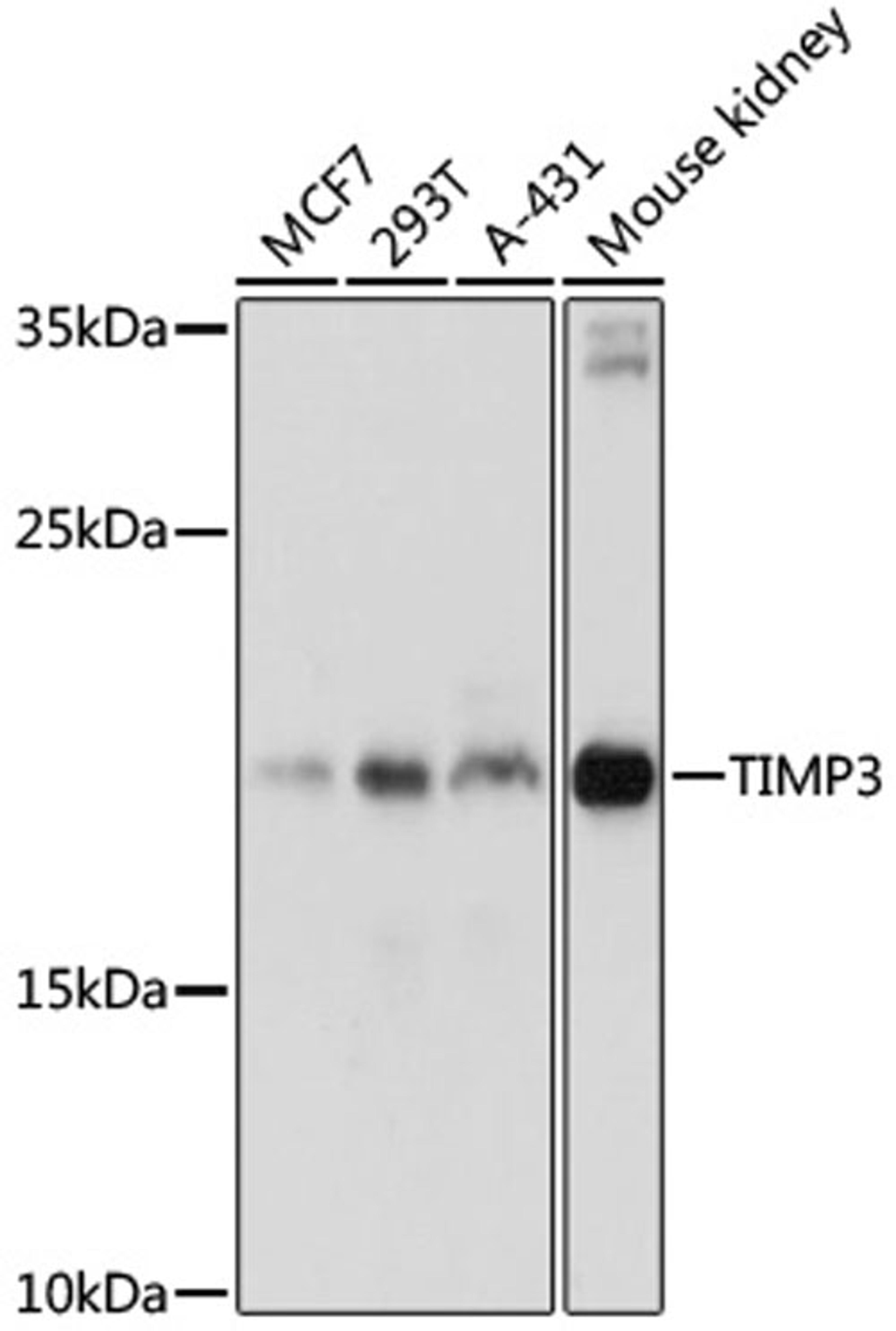 Western blot - TIMP3 antibody (A11986)