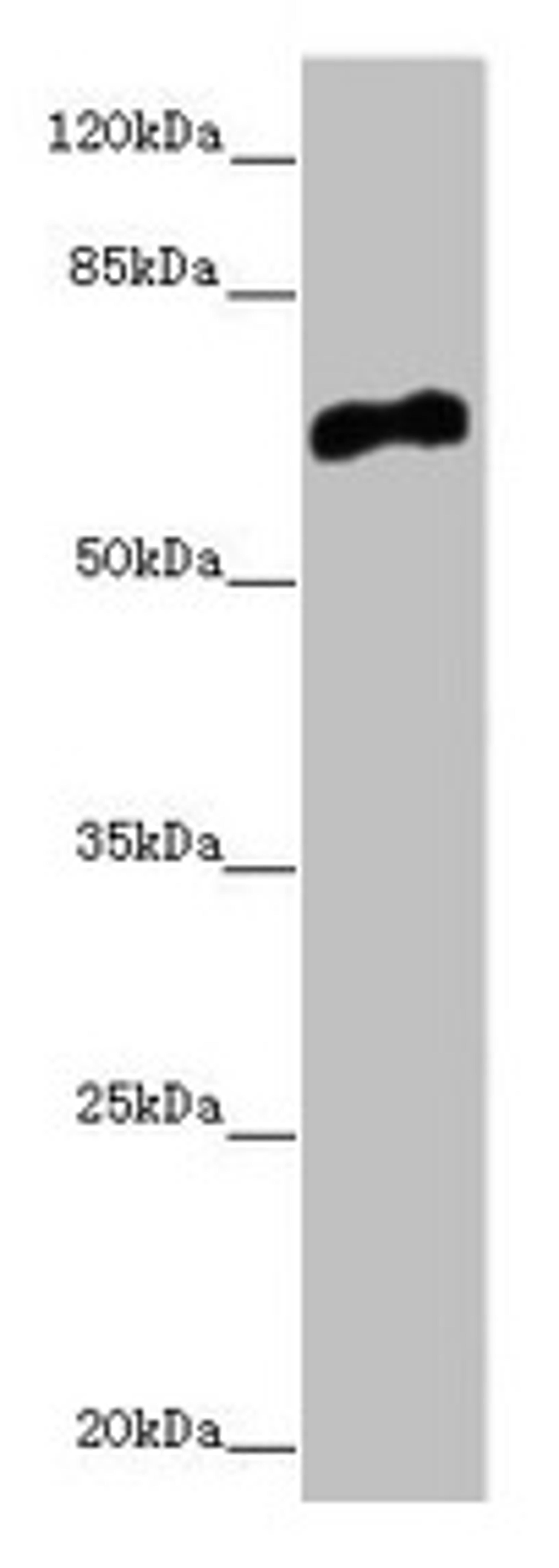 Western blot. All lanes: CACNB1 antibody at 6.68µg/ml + HepG2 whole cell lysate. Secondary. Goat polyclonal to rabbit IgG at 1/10000 dilution. Predicted band size: 66, 58, 54 kDa. Observed band size: 66 kDa