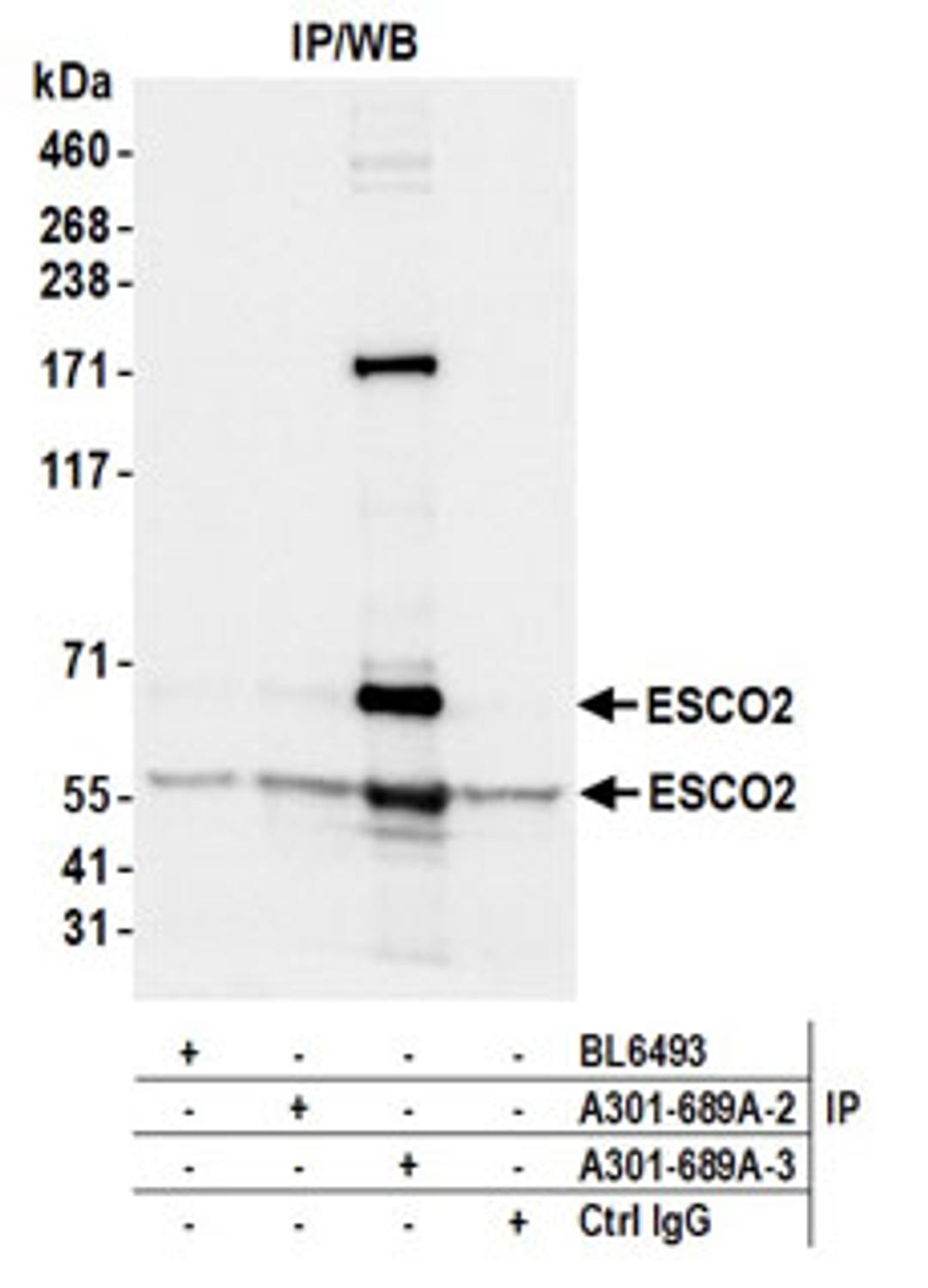 Detection of human ESCO2 by western blot of immunoprecipitates.