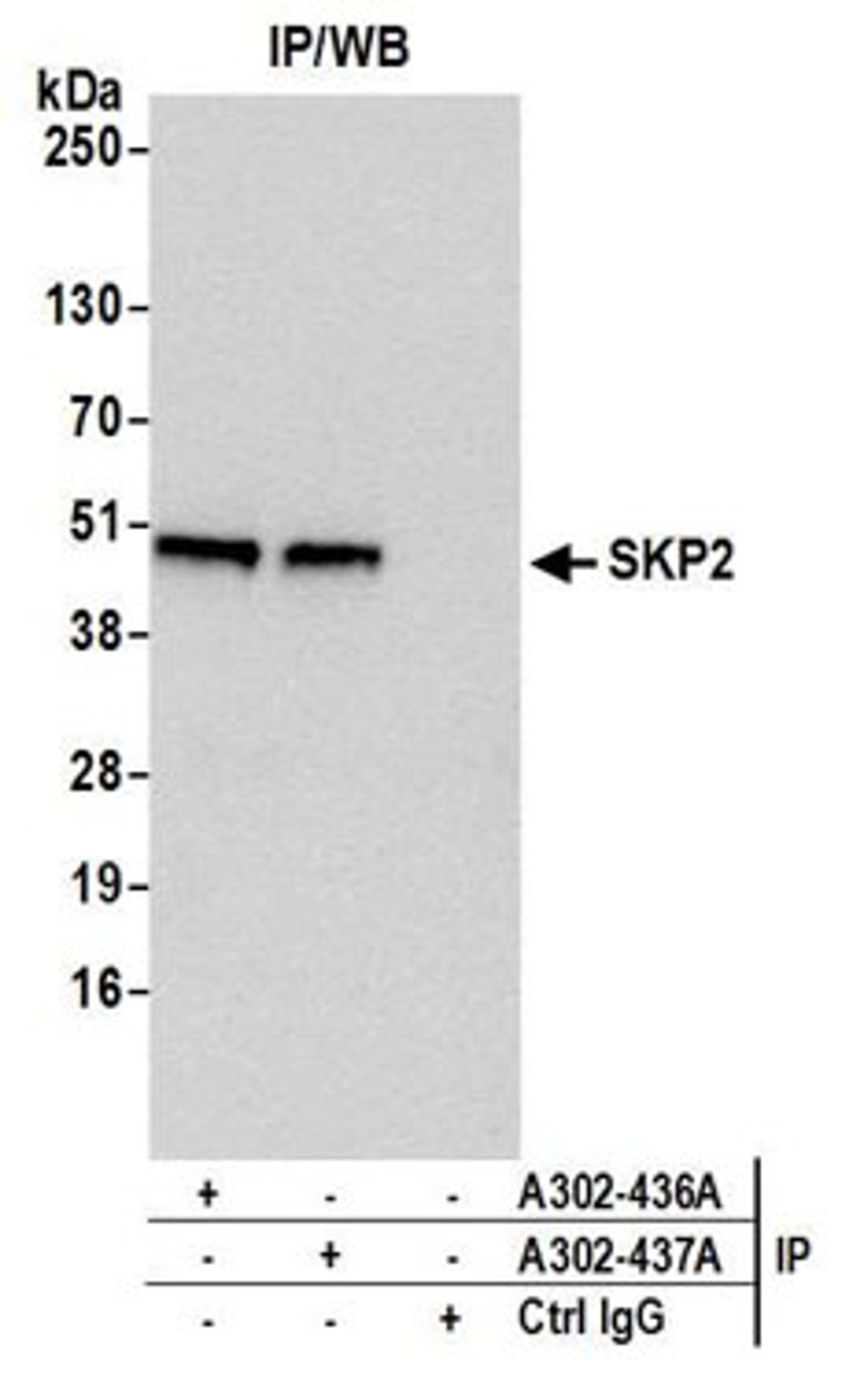 Detection of human SKP2 by western blot of immunoprecipitates.