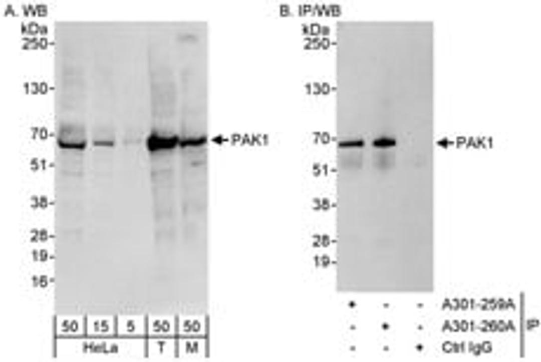 Detection of human and mouse PAK1 by western blot (h&m) and immunoprecipitation (h).