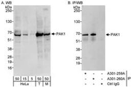 Detection of human and mouse PAK1 by western blot (h&m) and immunoprecipitation (h).