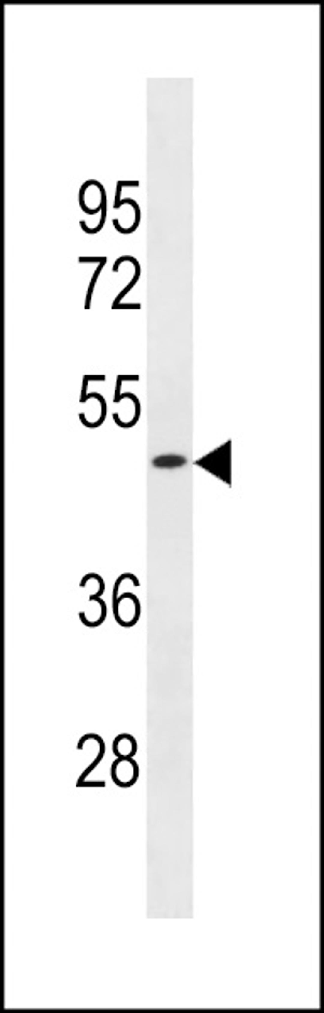 Western blot analysis in ZR-75-1 cell line lysates (35ug/lane).