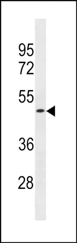 Western blot analysis in ZR-75-1 cell line lysates (35ug/lane).