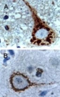 Immunohistochemistry-Paraffin: Caspase 9 Antibody [NB100-56118] - Analysis of Dog Brain sections stained for Active/Cleaved Caspase-9 expression at 1:2000. A and B. The pattern of Caspase-9 staining may vary between different types of neurons. Hematoxylin-eosin counterstain.