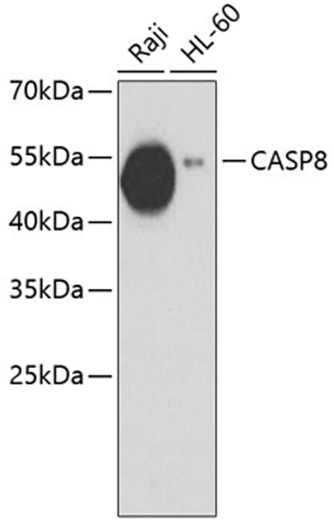 Western blot - Caspase-8 antibody (A11450)