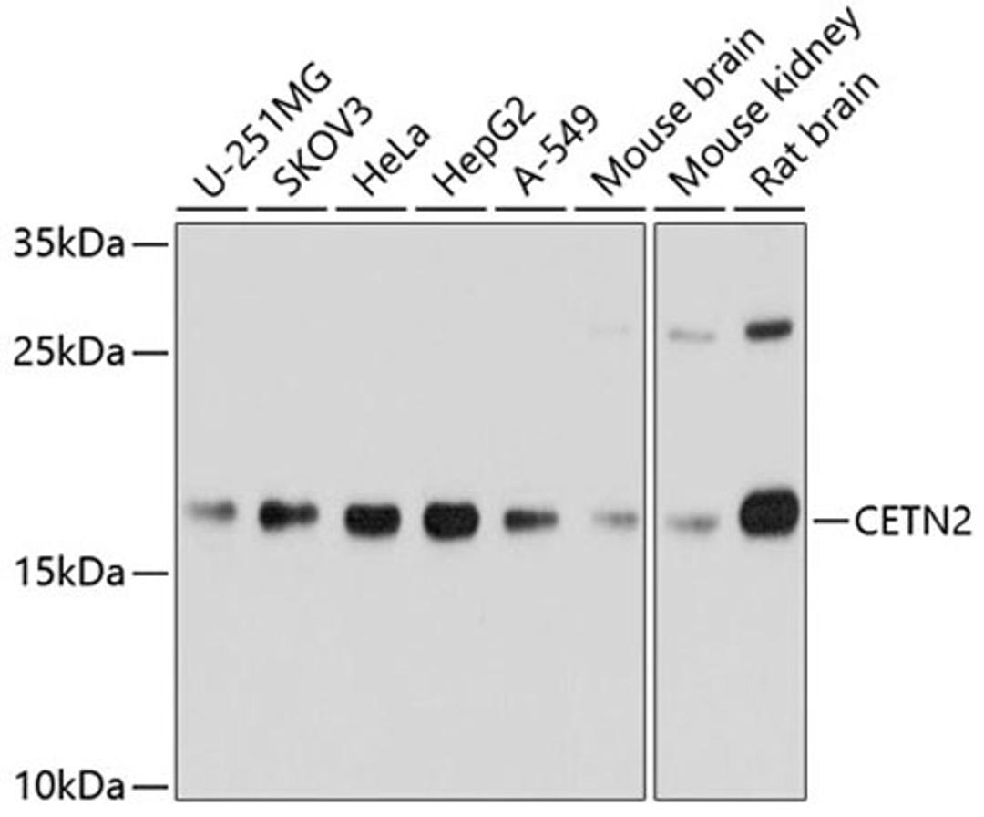 Western blot - CETN2 Antibody (A5397)