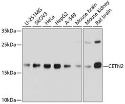 Western blot - CETN2 Antibody (A5397)