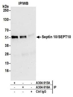 Detection of human Septin 10/SEPT10 by western blot of immunoprecipitates.