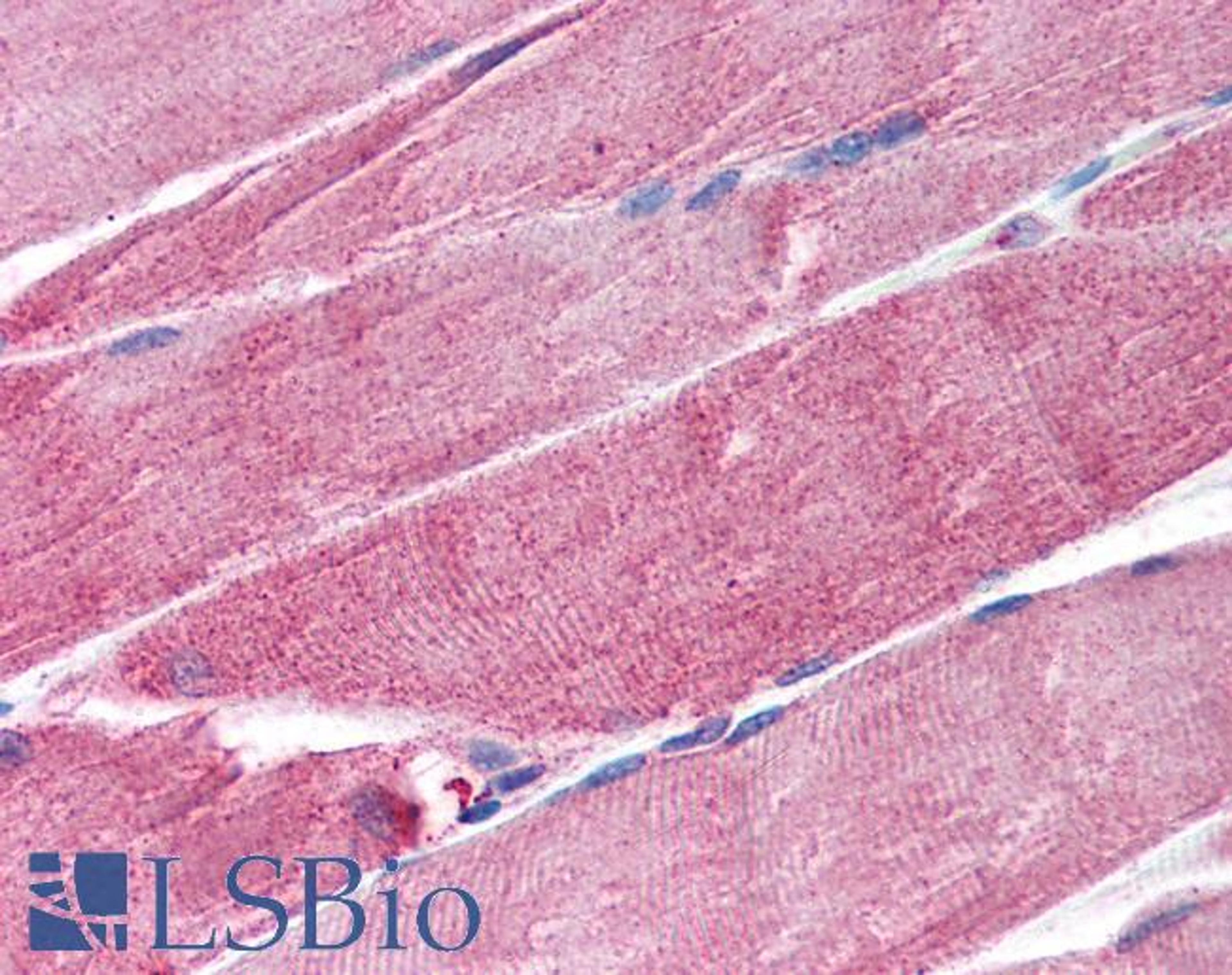 45-918 (1.25ug/ml) staining of paraffin embedded Human Skeletal Muscle. Steamed antigen retrieval with citrate buffer pH 6, AP-staining.