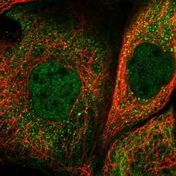 Immunocytochemistry/Immunofluorescence: ACSL6 Antibody [NBP1-89269] - Staining of human cell line A-431 shows positivity in nucleus but not nucleoli & cytoplasm.