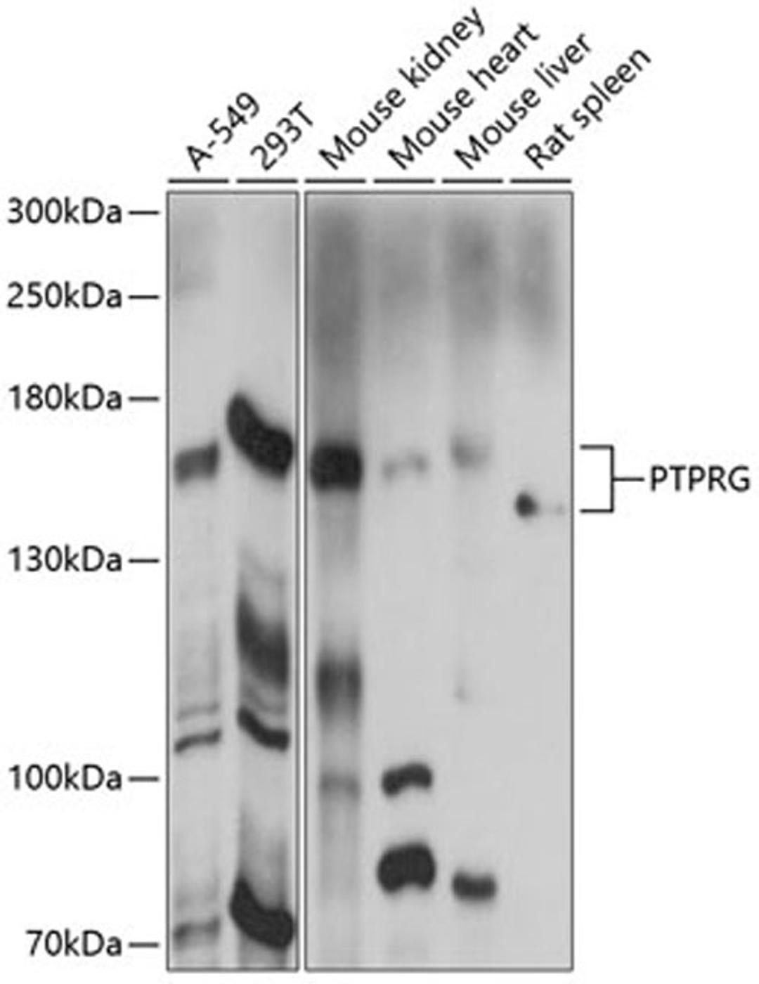 Western blot - PTPRG antibody (A14253)