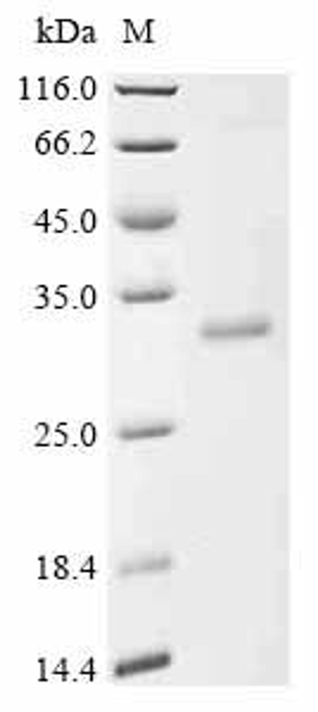 (Tris-Glycine gel) Discontinuous SDS-PAGE (reduced) with 5% enrichment gel and 15% separation gel.