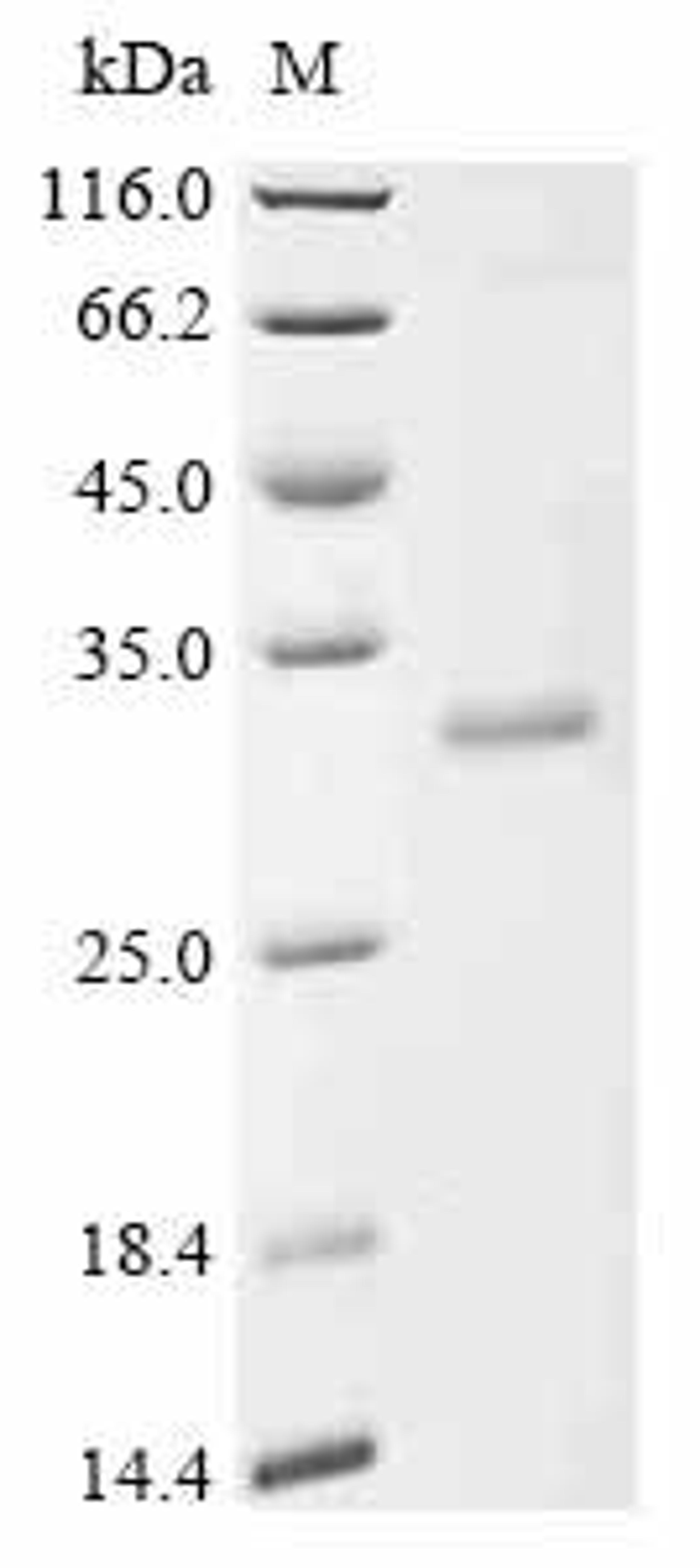 (Tris-Glycine gel) Discontinuous SDS-PAGE (reduced) with 5% enrichment gel and 15% separation gel.