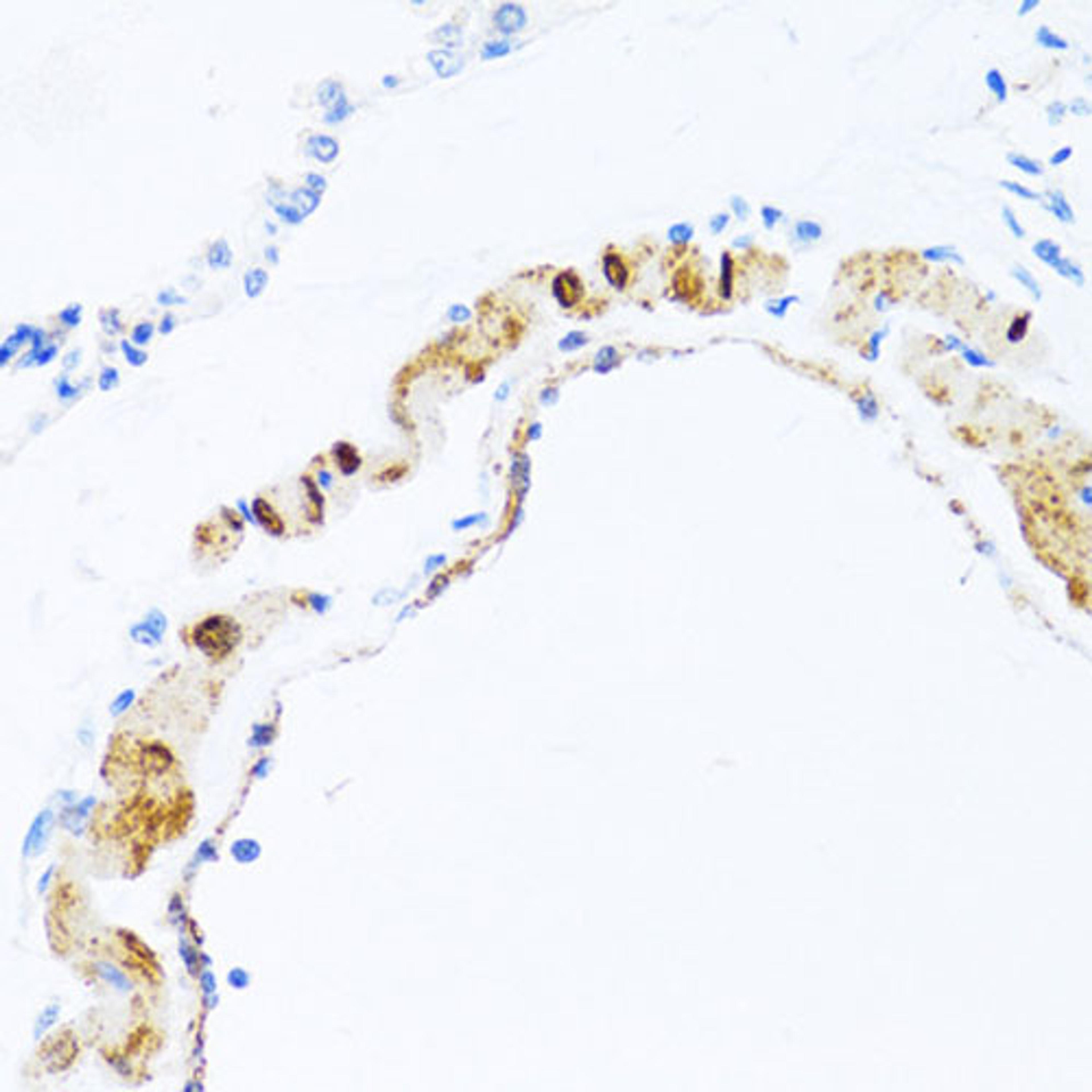 Immunohistochemistry  - PHPT1 antibody (A1127)