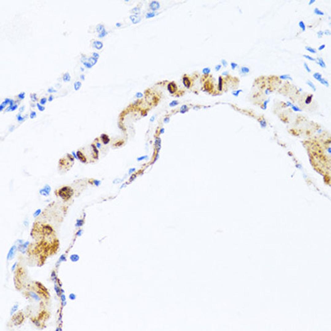 Immunohistochemistry - PHPT1 antibody (A1127)