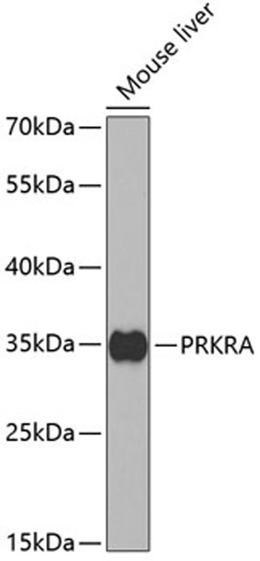 Western blot - PRKRA antibody (A5417)