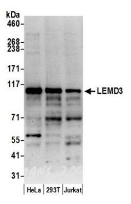 Detection of human LEMD3 by western blot.