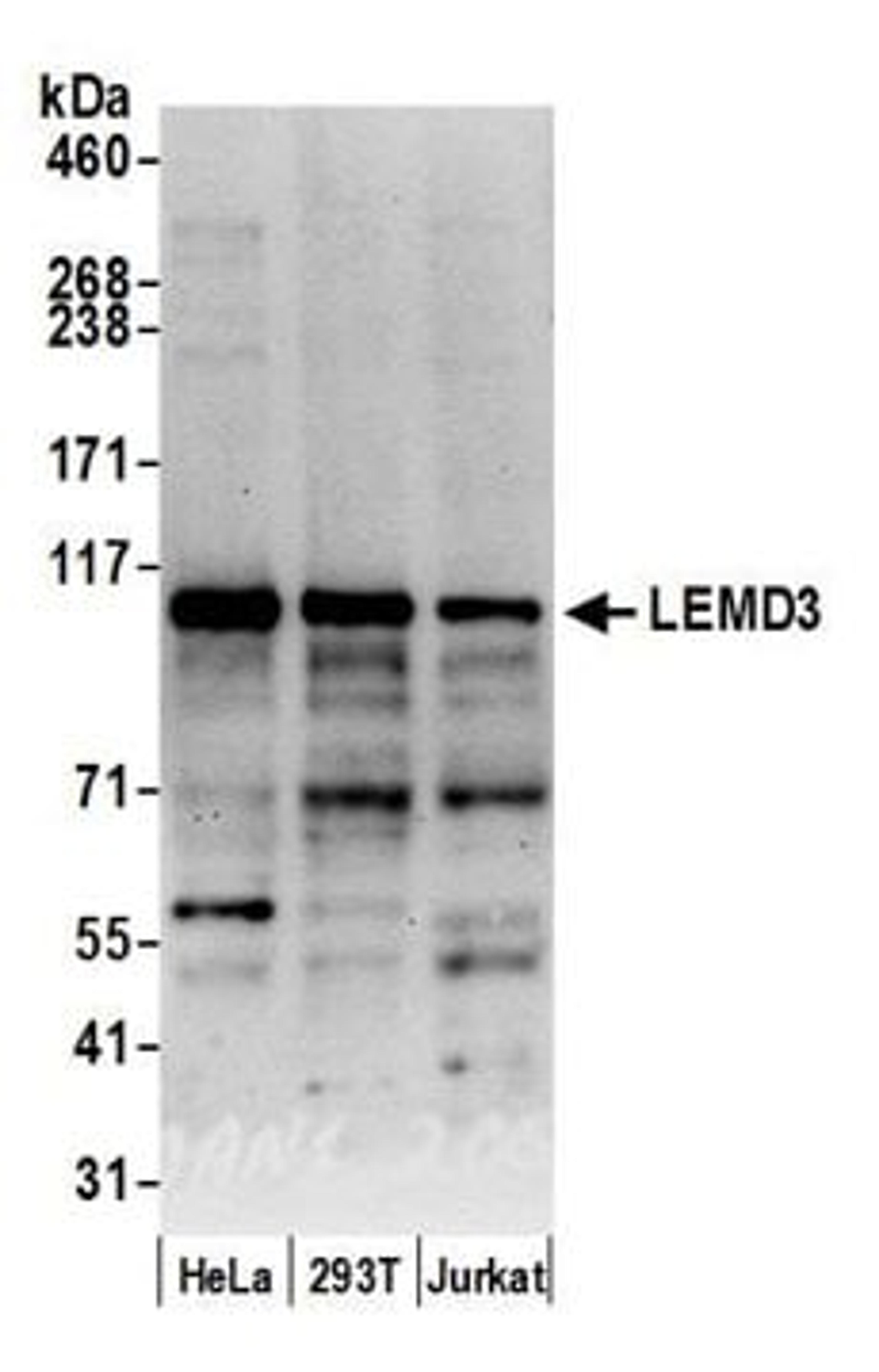 Detection of human LEMD3 by western blot.