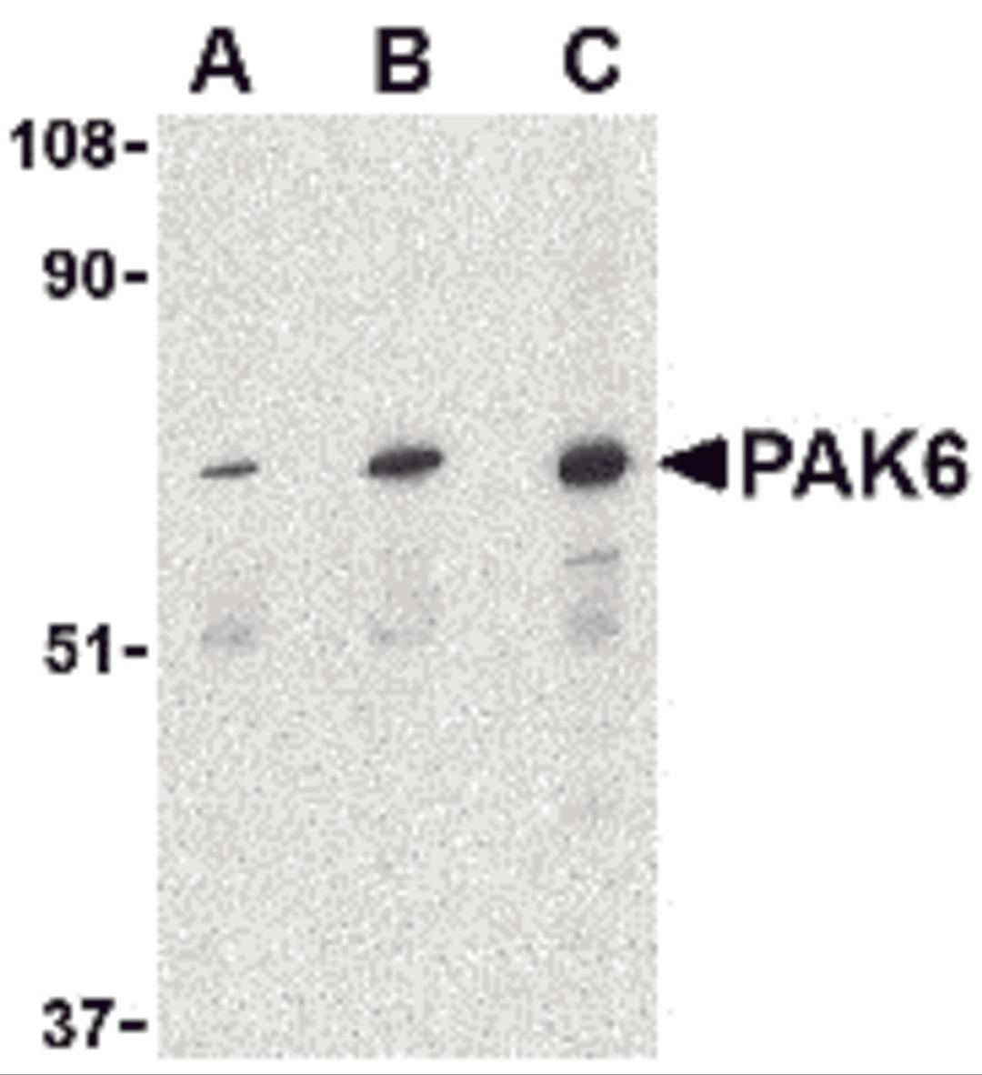 Western blot analysis of PAK6 in Raji lysate with PAK6 antibody at (A) 1, (B) 2, and (C) 4 &#956;g/mL.