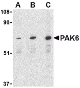 Western blot analysis of PAK6 in Raji lysate with PAK6 antibody at (A) 1, (B) 2, and (C) 4 &#956;g/mL.